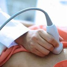 echocardiography